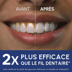 Waterpik – Hydropulseur Ultra professionnal, Jet dentaire avec 6 embouts et 10 niveaux de pression, Élimine la plaque, Blanc (WF-660EU)